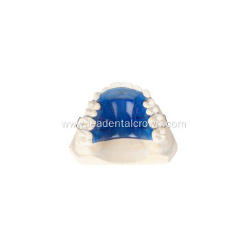 Orthodontic Retainers: Essential Devices for Post-Treatment Care